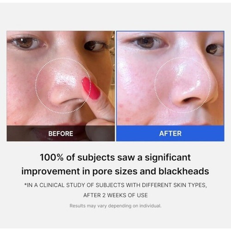 Medicube Zero Pore Pad - Dual-Textured Facial Toner Pads 70 Pads Exfoliates