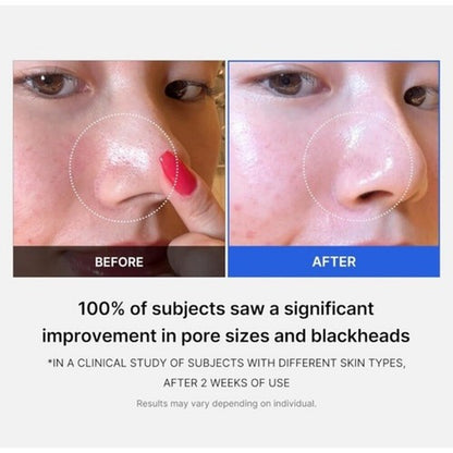 Medicube Zero Pore Pad - Dual-Textured Facial Toner Pads 70 Pads Exfoliates